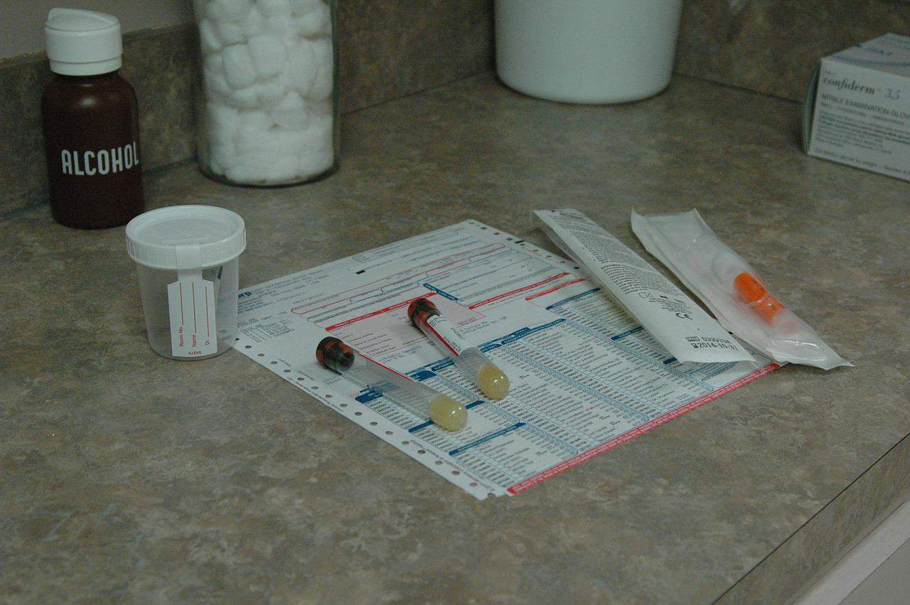 drug tests samples